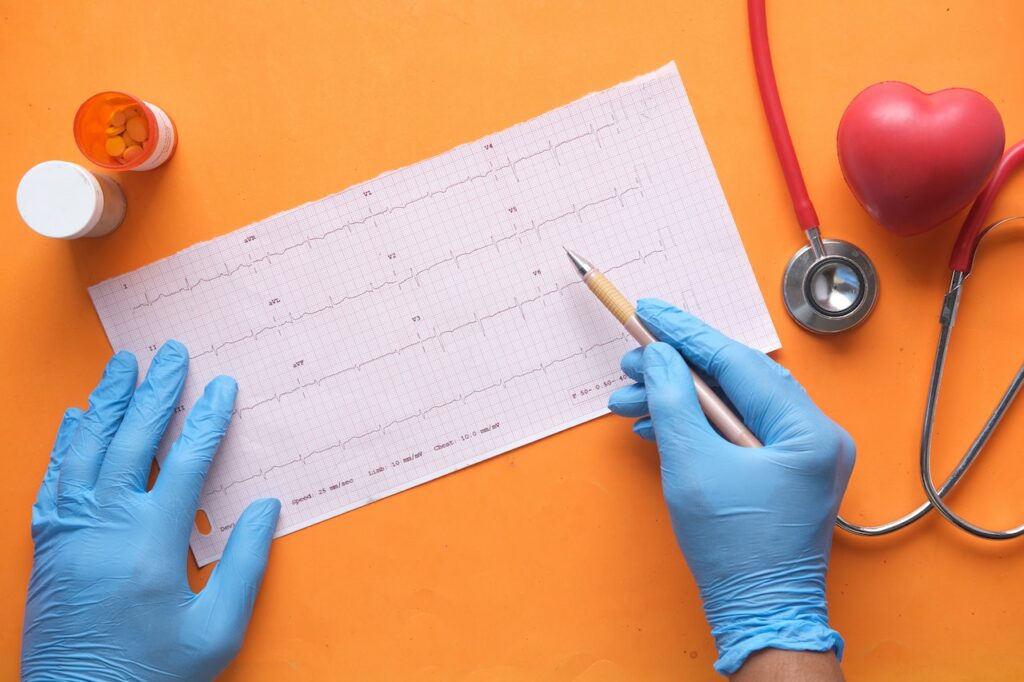 Ein Elektrokardiogramm Bericht und zwei Hände