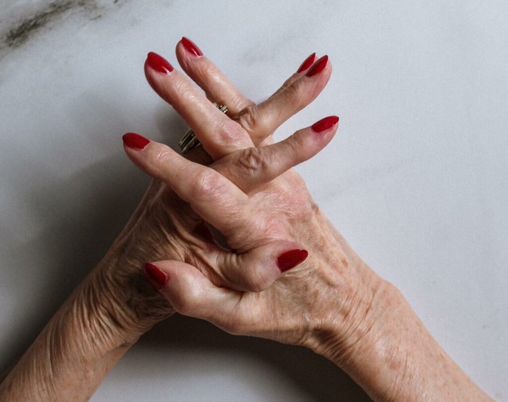 Gefaltete Hände einer älteren Frau