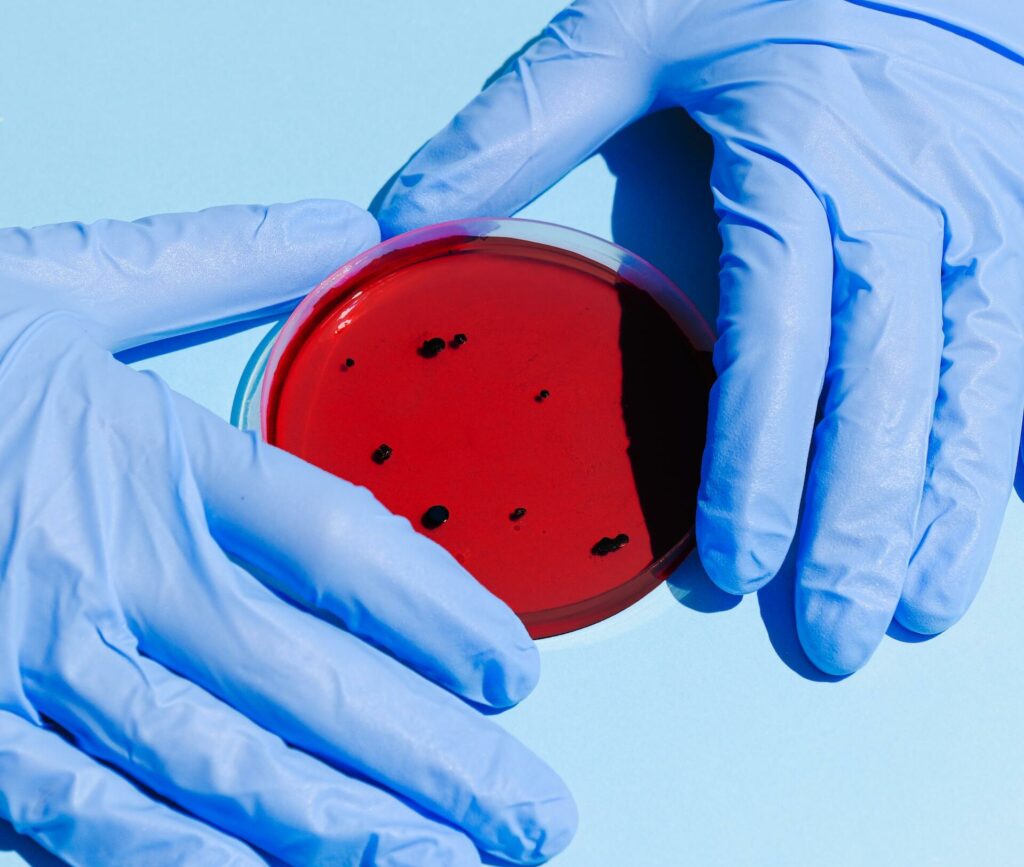 Blutprobe und Hände in Labor-Handschuhen