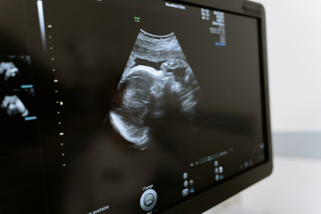 Ultraschall eines Kindes im Bauch einer Schwangeren Frau