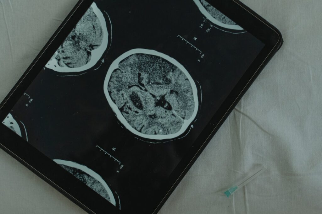 Scan eines Gehirns auf einem Tablet