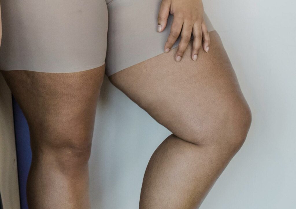 Beine einer Frau