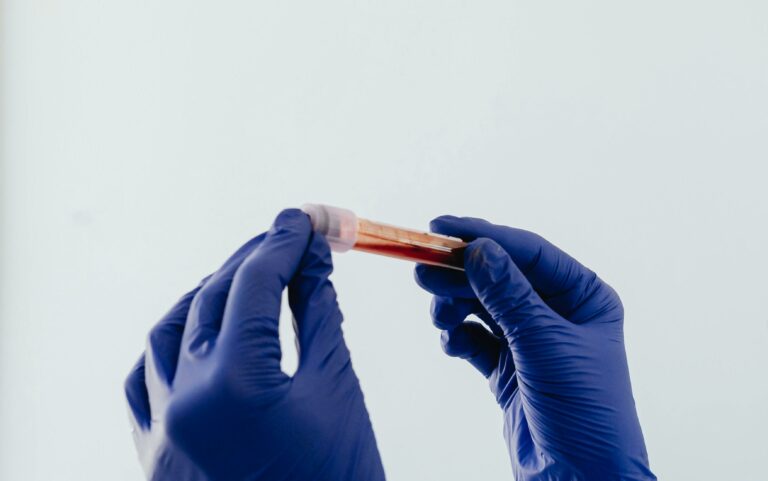 Blutprobe gehalten durch zwei Hände